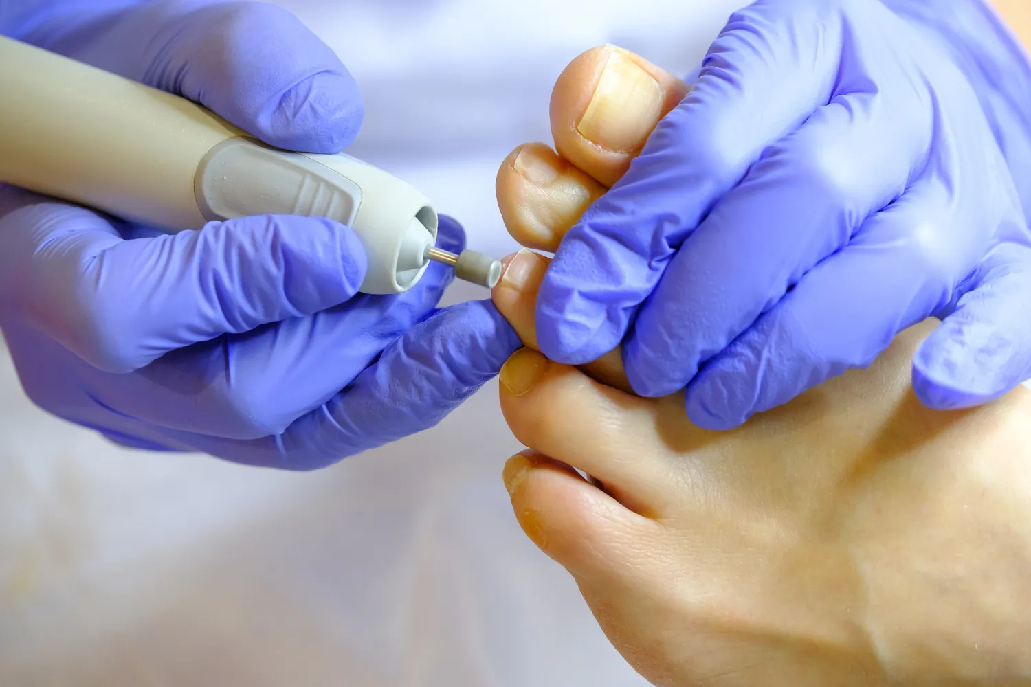 Pedicure leczniczy Warszawa