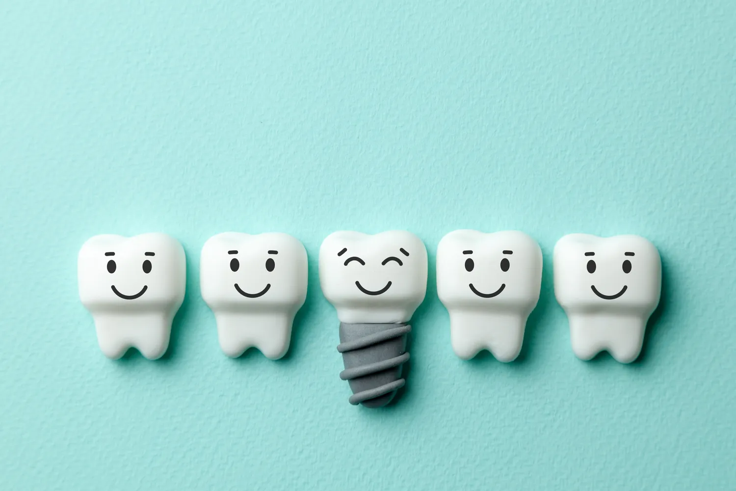 na-czym-polega-leczenie-kanalowe-f