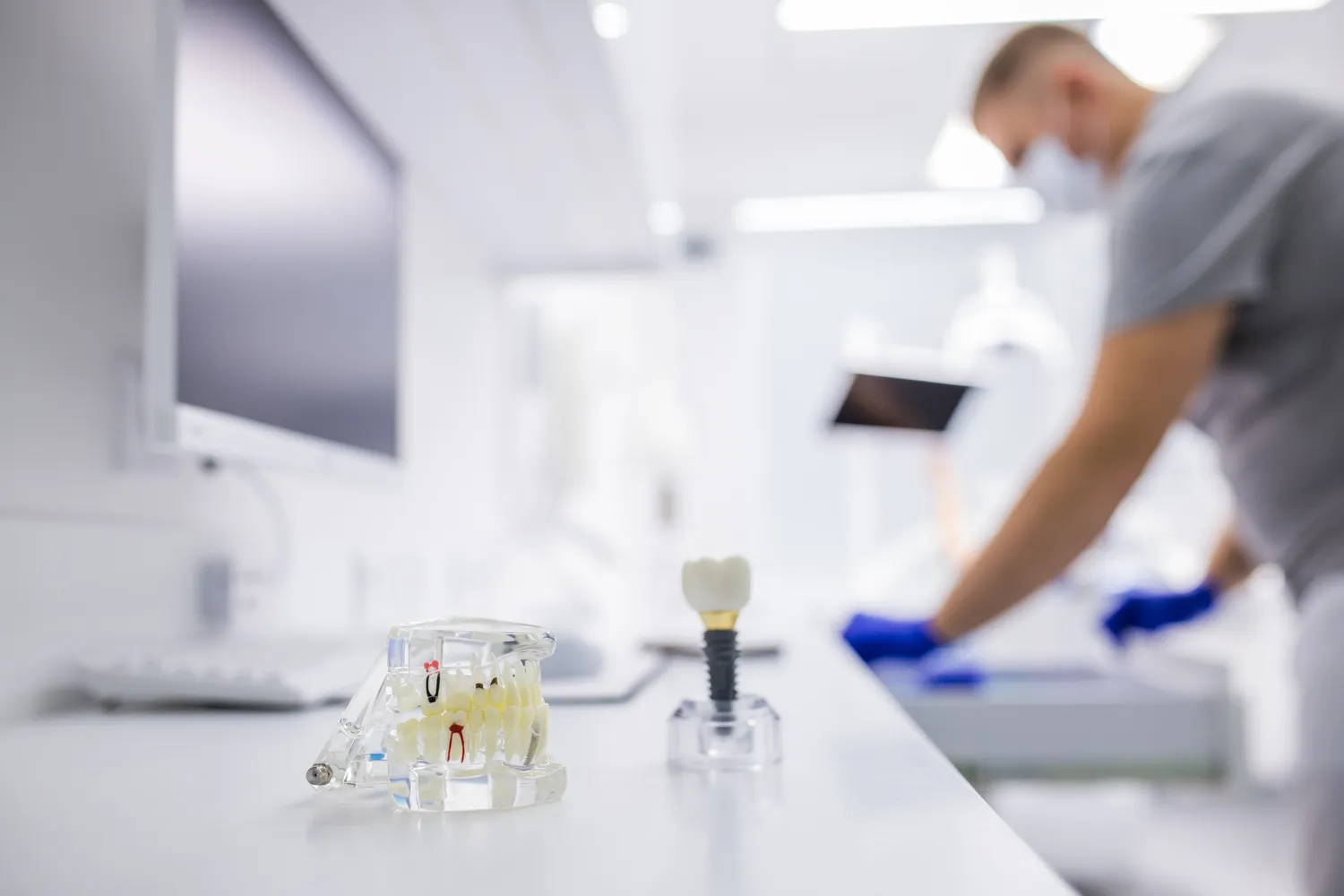 Na ile lat implanty zębów?