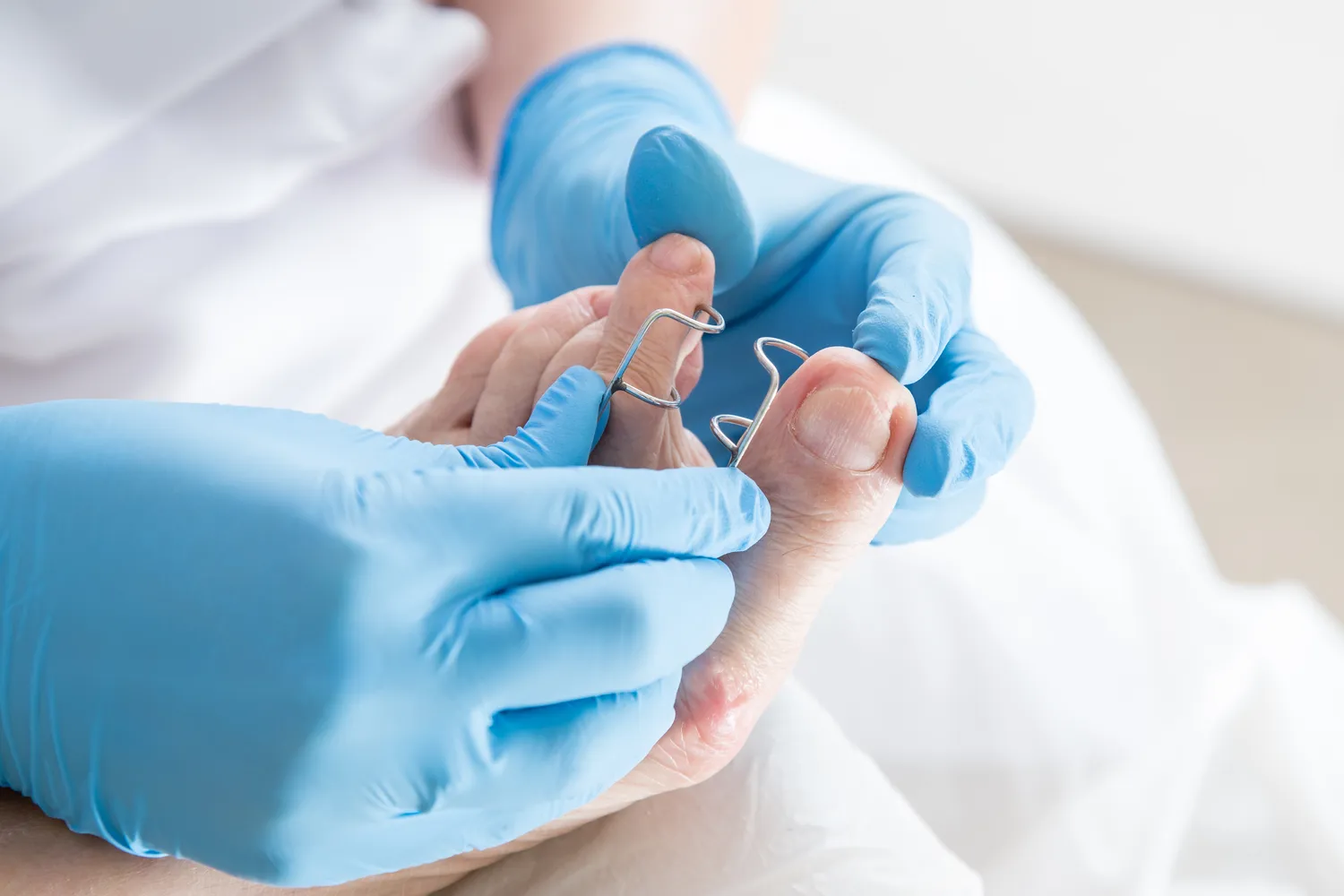 zadbaj-o-swoje-stopy-juz-dzis-podologia-na-ratunek-f